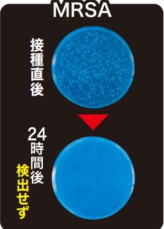 MRSA（メチシリン耐性黄色ブドウ球菌）検査結果
